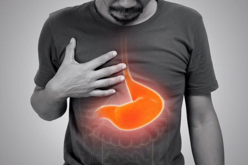 síntomas del reflujo gastroesofágico